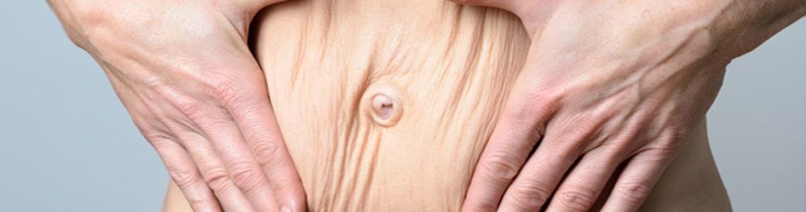 Skin tightening in San Antonio